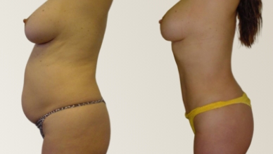 bodysurgery img Home - 3