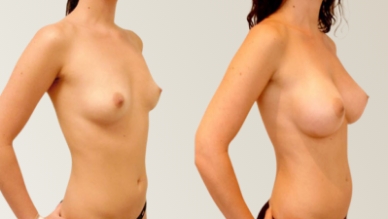 breastsurgery img Home - 2