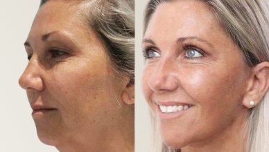 facesurgery img Home - 4